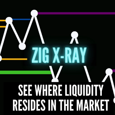 「ZigXRay」ロゴ