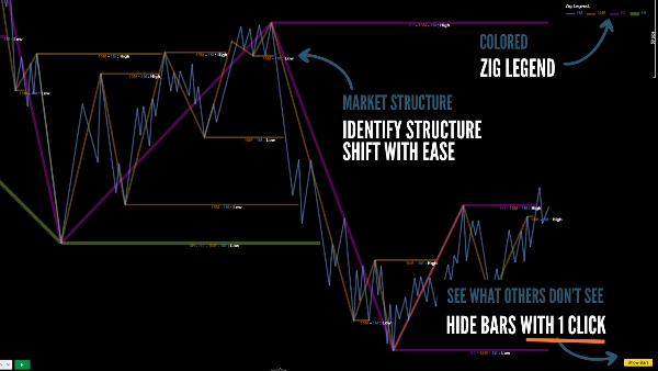 "ZigXRay" uploaded image