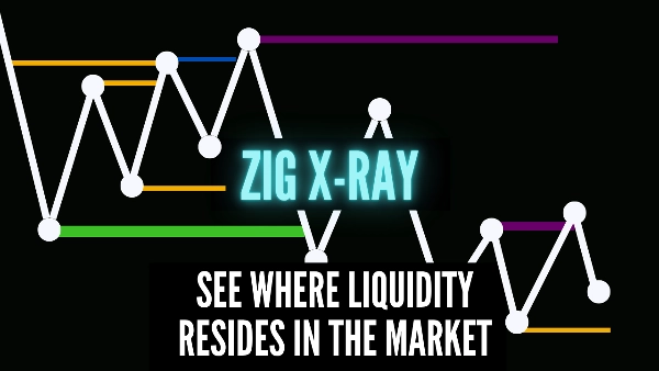 "ZigXRay" uploaded image