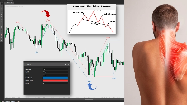 "Head And Shoulders" uploaded image