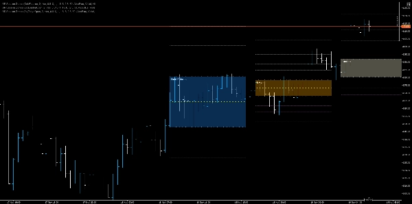 "OR Session Zones" ภาพที่อัปโหลด
