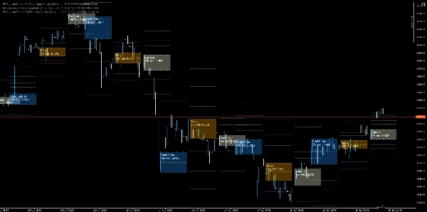 "OR Session Zones" ภาพที่อัปโหลด